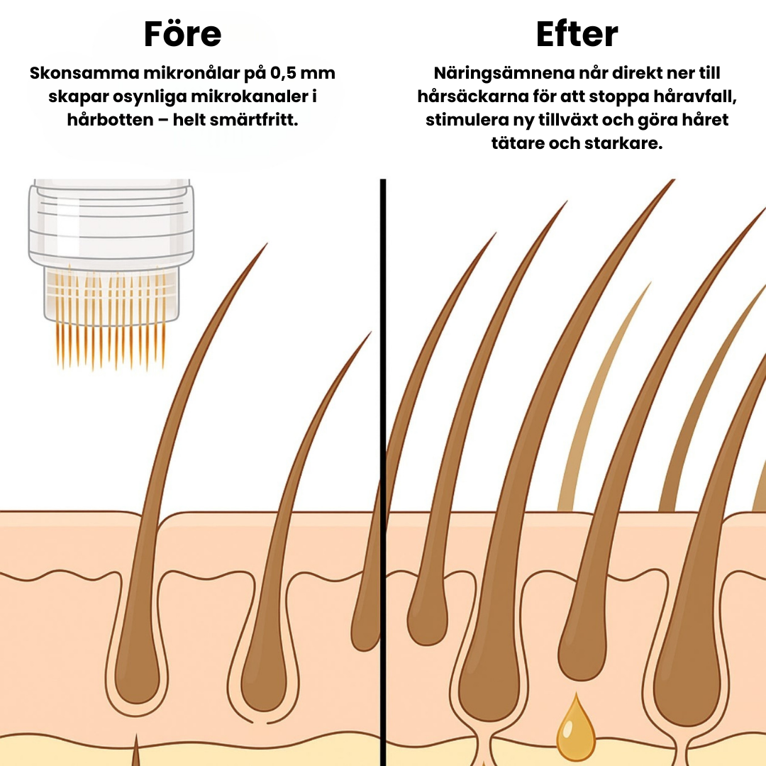 ReRoot™ - Stoppa håravfallet utan dyra klinikbesök